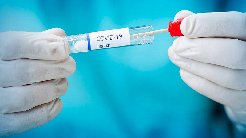 covid 19 test