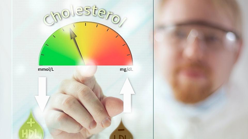 Cholesterol