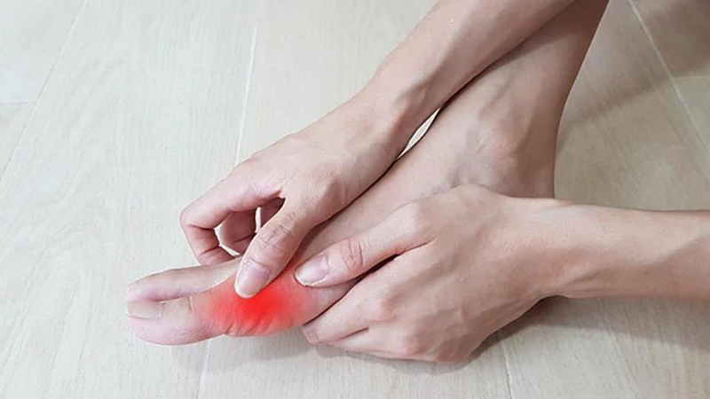 Gout