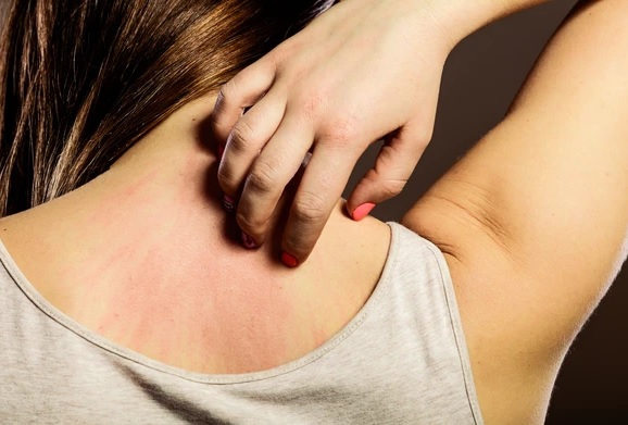 skin problem