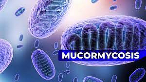 Mucormycosis