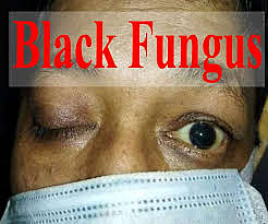 black fungus