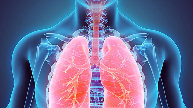 Tuberculosis