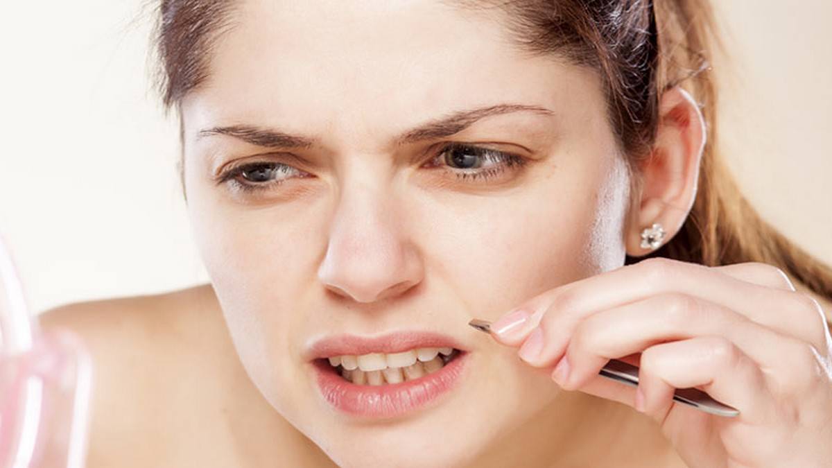 Unwanted Hair in Women