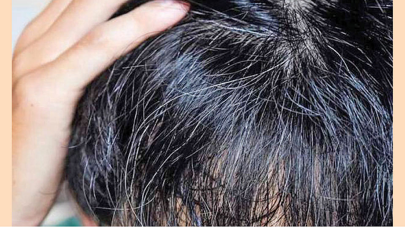 Hair