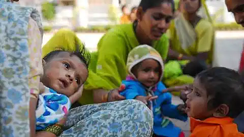 कुपोषित