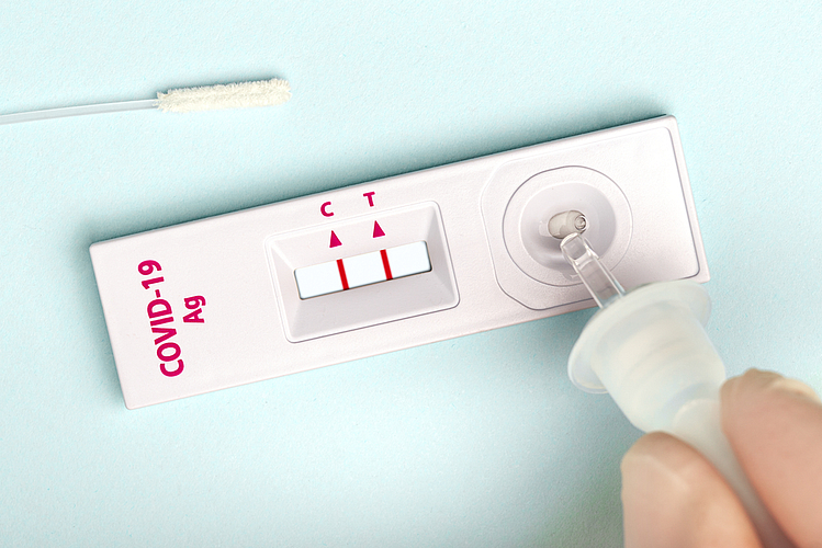Covid Test At Home : फक्त २५० रुपयांमध्ये अवघ्या १५ मिनिटांत करा रॅपीड टेस्ट?