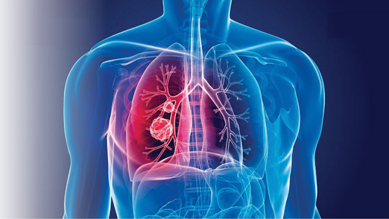 Lungs