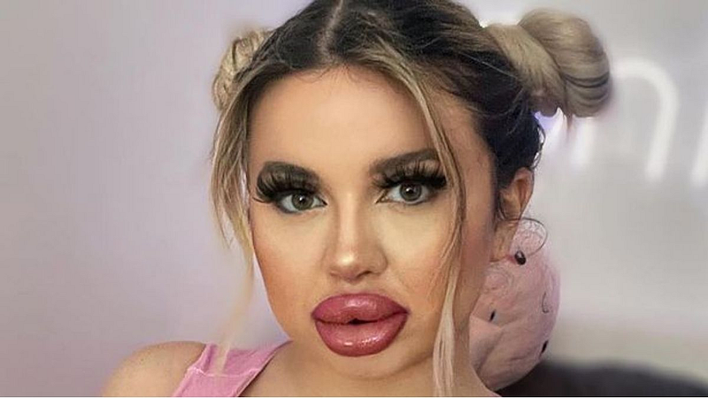 Woman Spends Rs 53 Lakh to Turn Herself into 'Human Barbie'