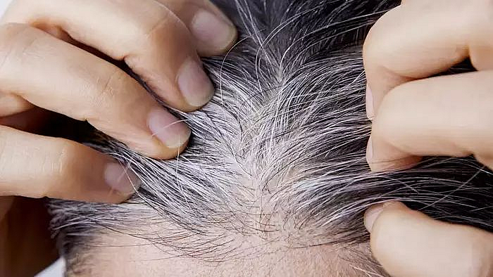 white hair