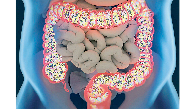 microbiome
