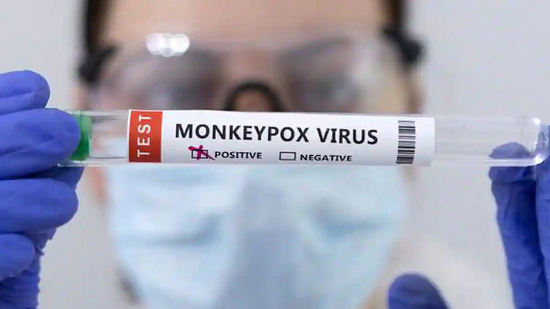 Monkeypox Latest News