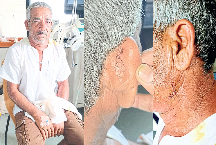Injured Farmer