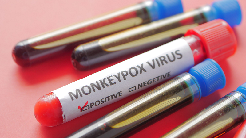monkeypox Latest Marathi News
