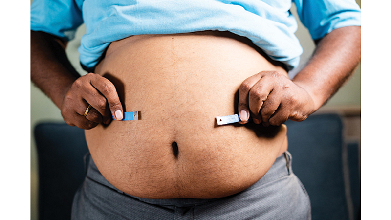 Stomach Fat