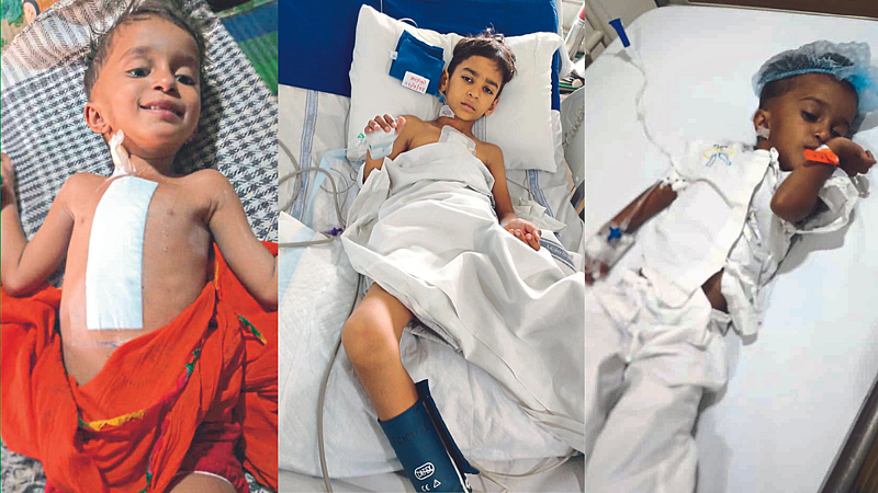 children has undergone surgery