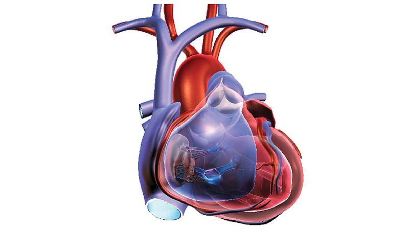 Heart Sickness