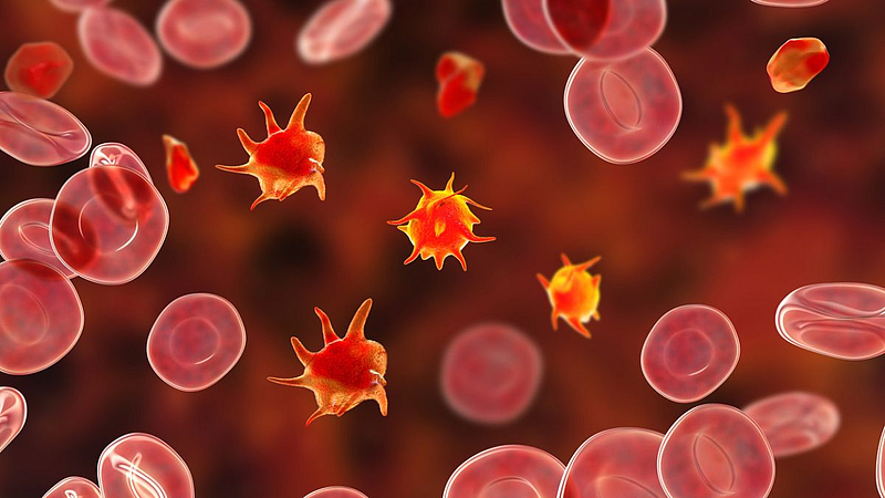 Immune thrombocytopenia
