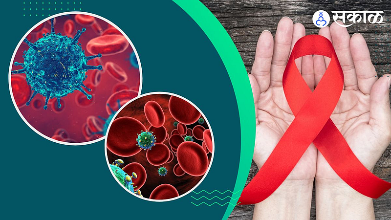 HIV AIDS Symptoms