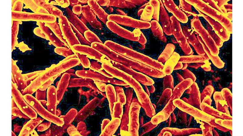 tuberculosis