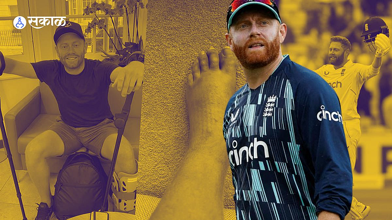 Jonny Bairstow Broke Leg In Three Places successful surgery