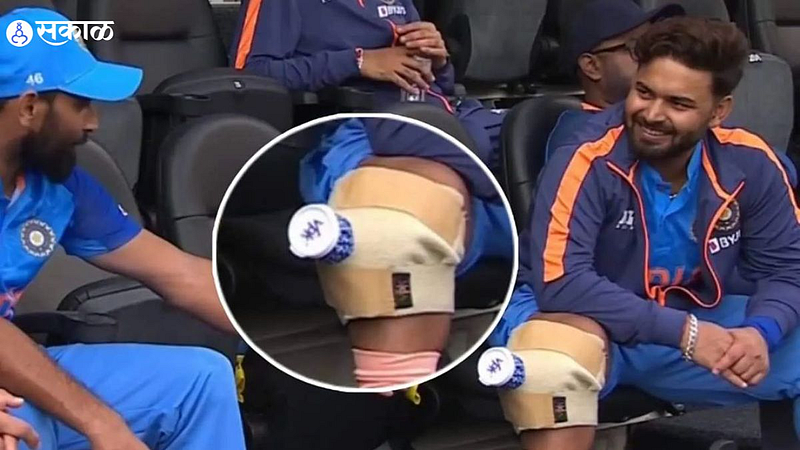 Rishabh Pant Ice Pack