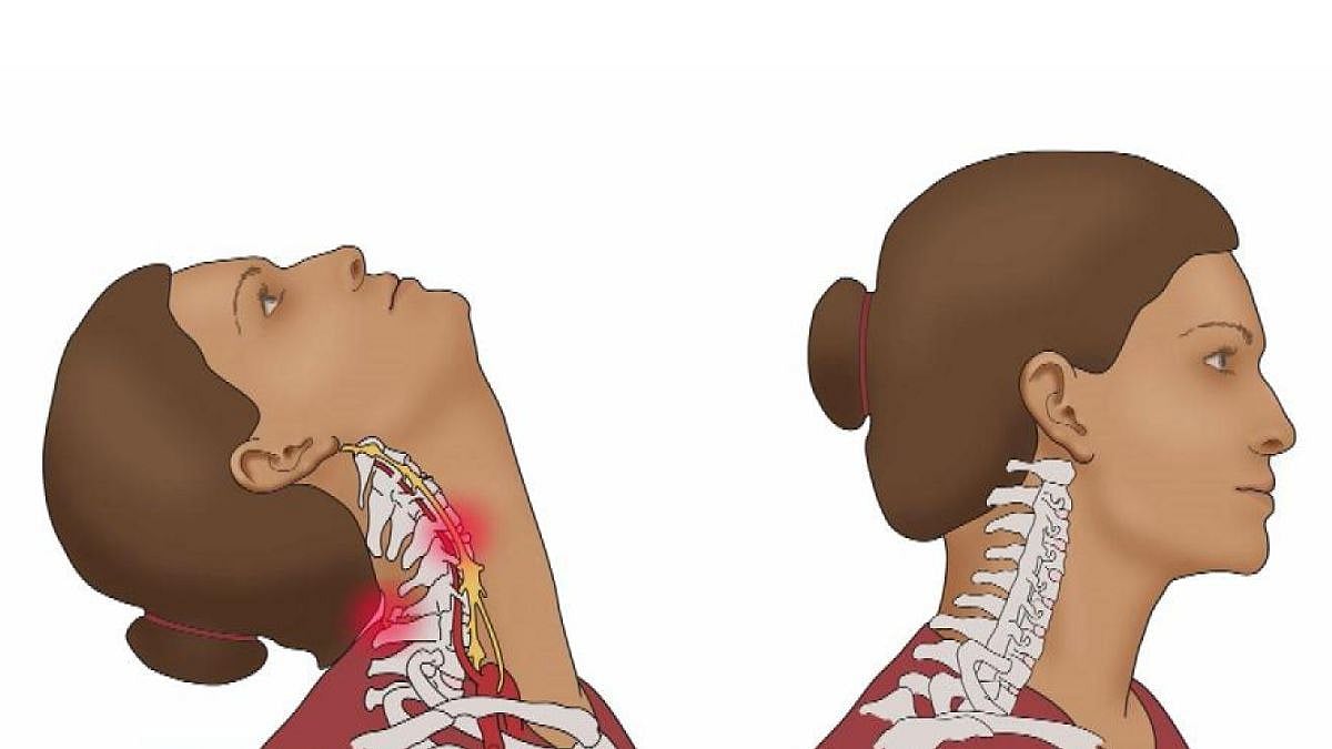 Beauty Parlour Stroke Syndrome : पार्लरमध्ये केस धुतल्याने होतो मृत्यू?  जाणून घ्या | Sakal