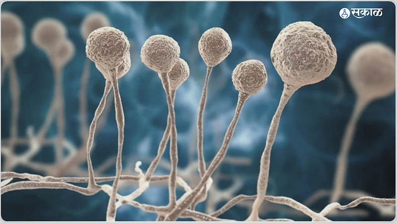 mucormycosis disease