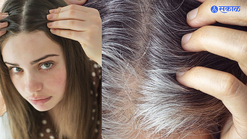 White Hair Remedy