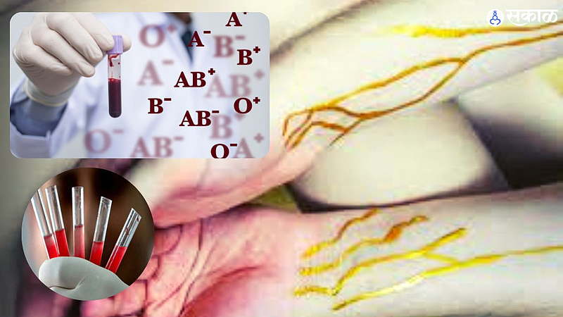 Golden Blood Group