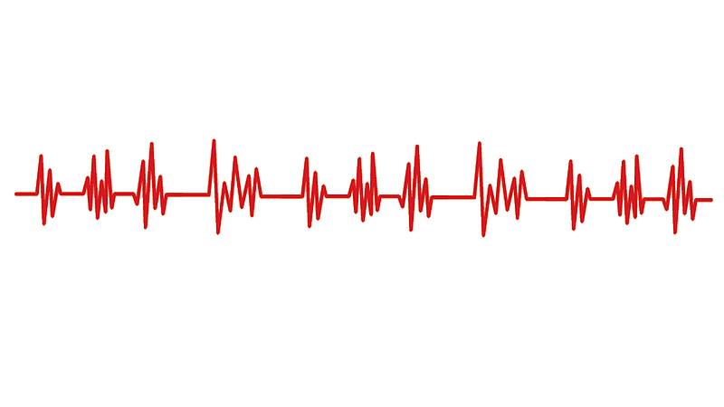 arrhythmia