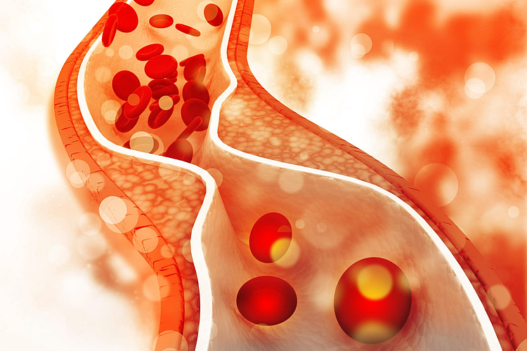 How to Control Cholestrol