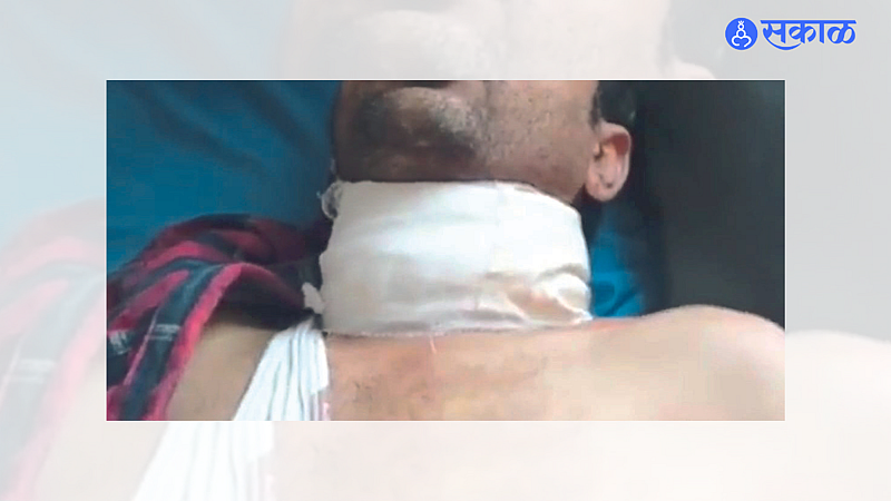 Injured Youth