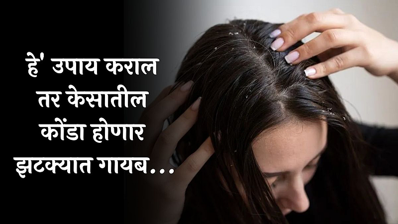 Dandruff Remove