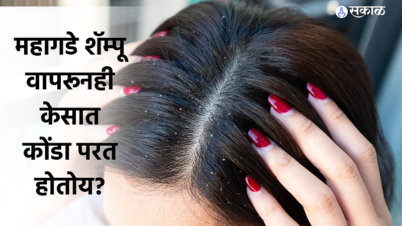 Dandruff Treatment