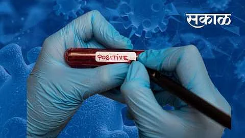 धुळे जिल्हाधिकारी संजय यादव यांना कोरोनाची बाधा }