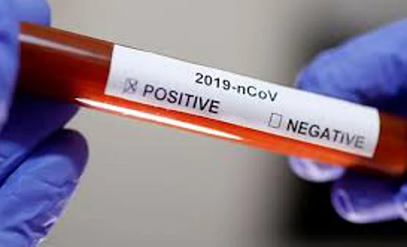 Nine more patients corona positive in Yavatmal district