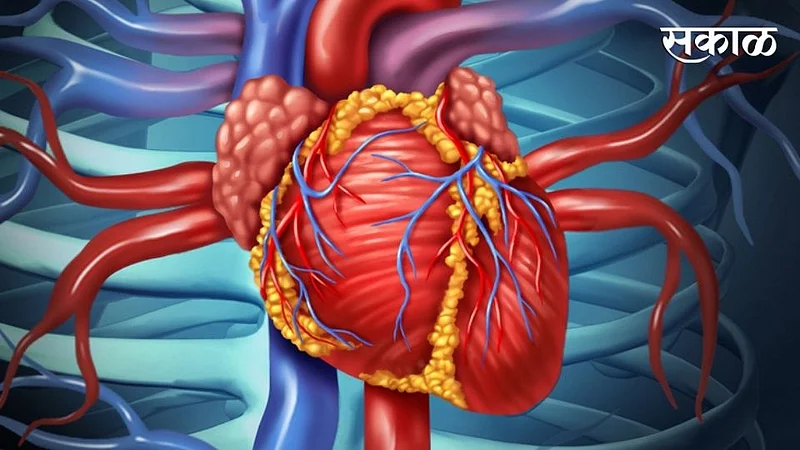 heart surgery (1).jpg