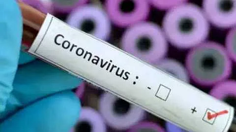 2corona_agencies_1.jpg