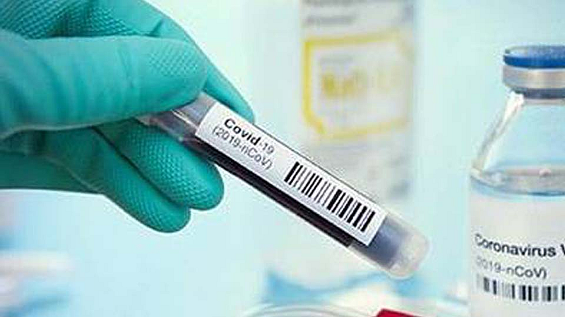 आंबेगाव तालुक्यात आज 22 नवे पॉझिटिव्ह