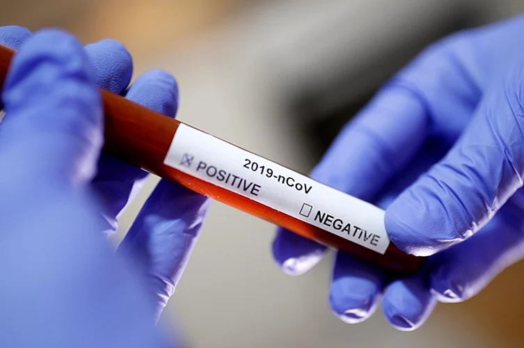corona test positive in buldana.jpg
