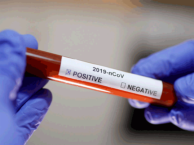 781 people corona negative in belgaum