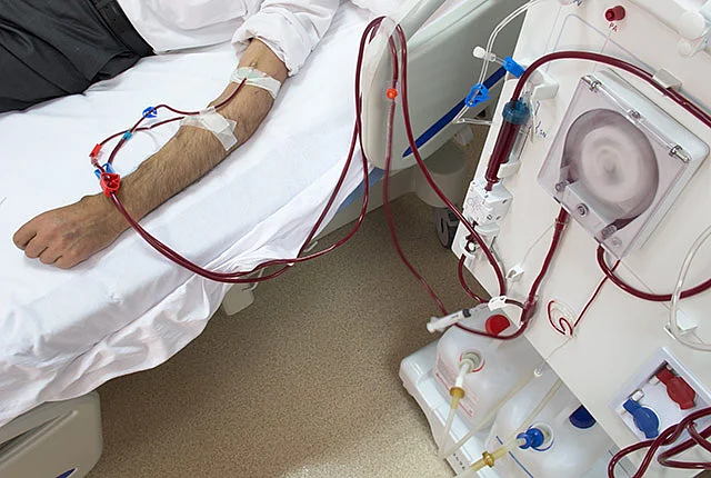 dialysis patient