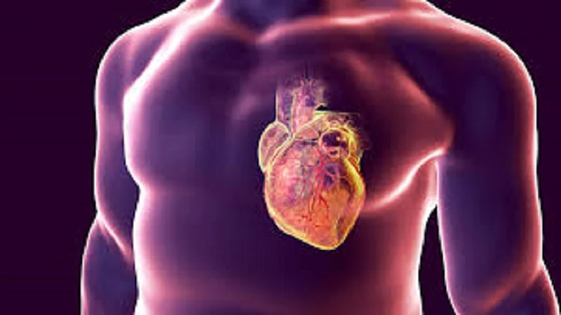 heart attack