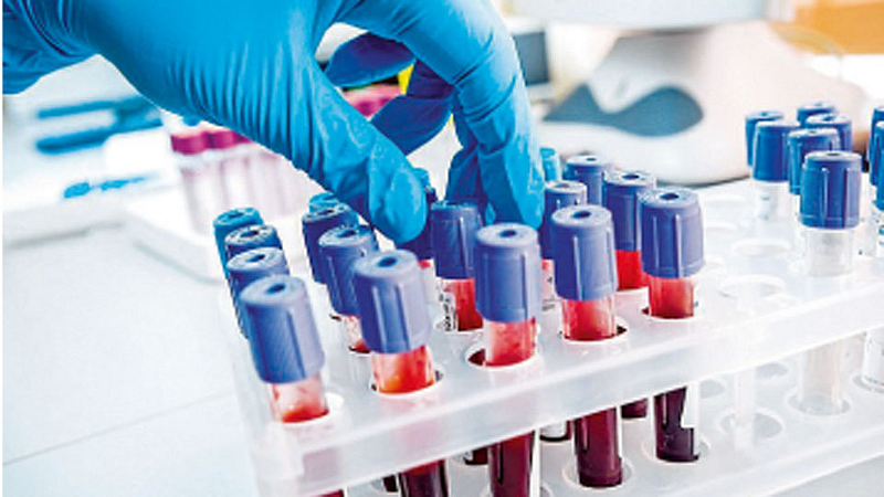 Blood-Test