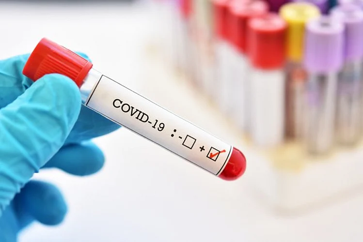 corona test in sangrampur.jpg