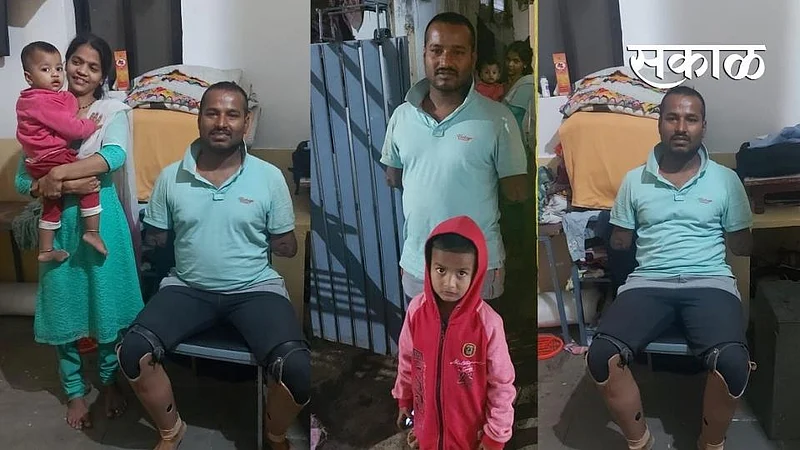 prakash Stood on an artificial foot after Accident but need financial help the artificial hands