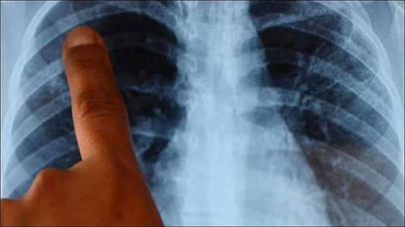 iit professor develops software to detect covid 19 in 5 seconds using x ray scan of suspected patient