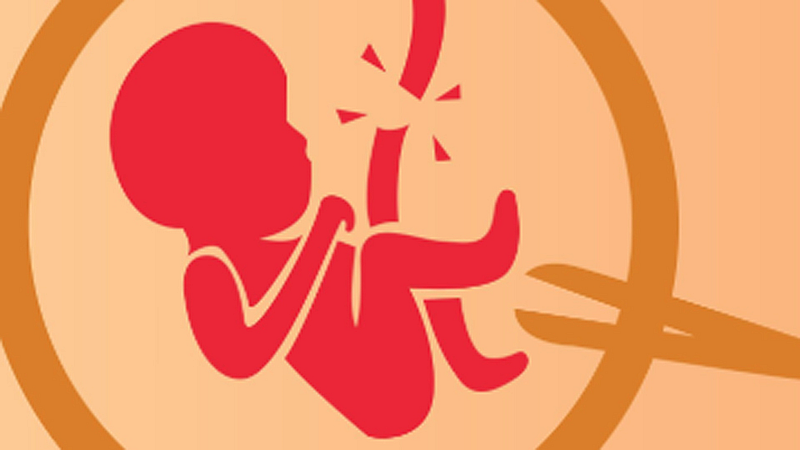 abortion
