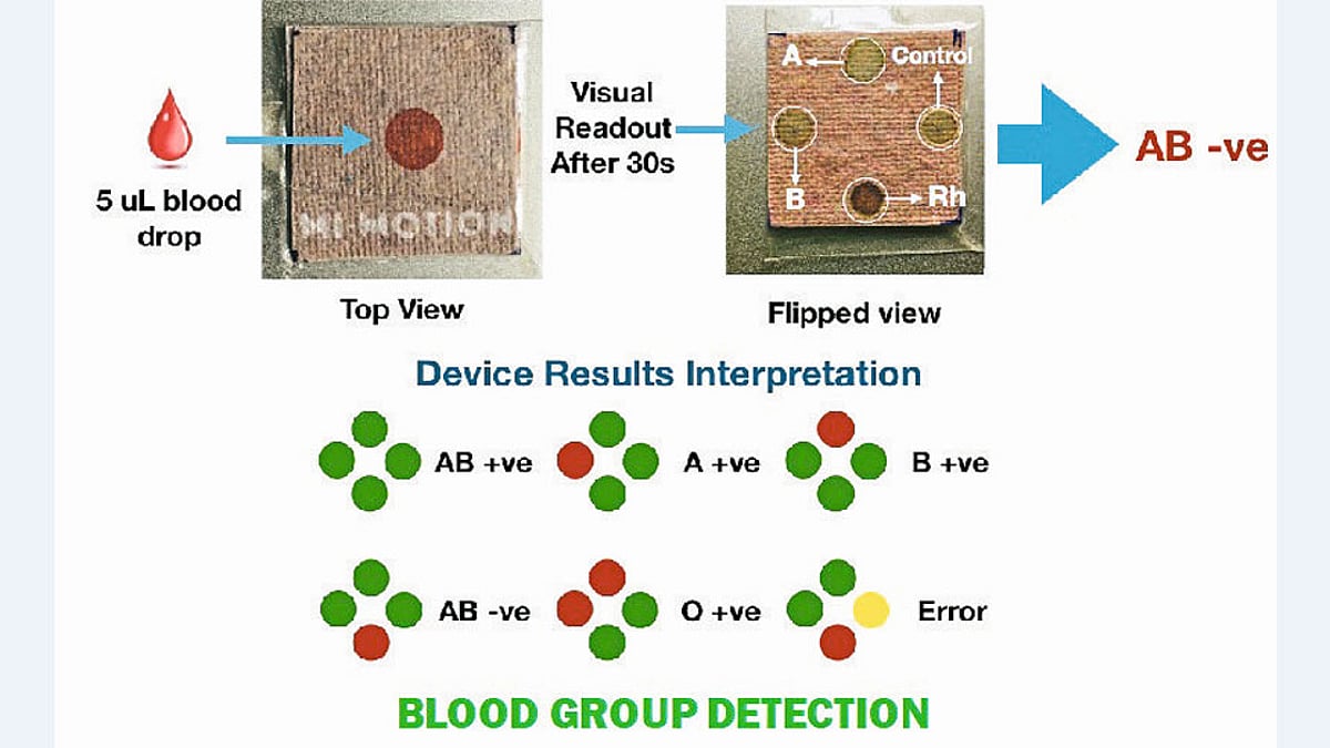 अवघ्या ३० सेकंदांत रक्तगट कळणार | Sakal